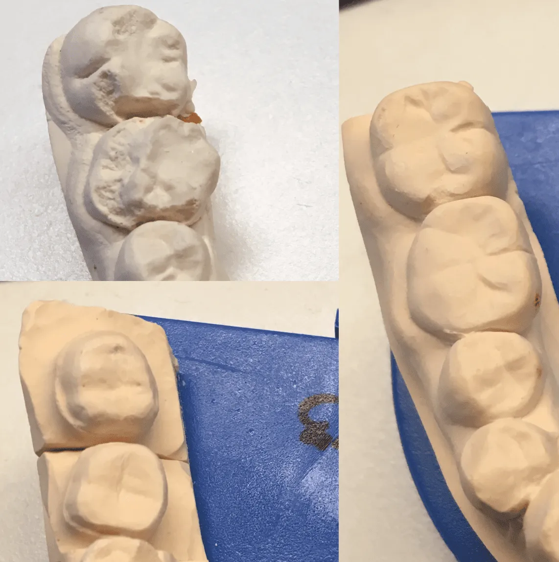 修复前、过程中、修复后的状态